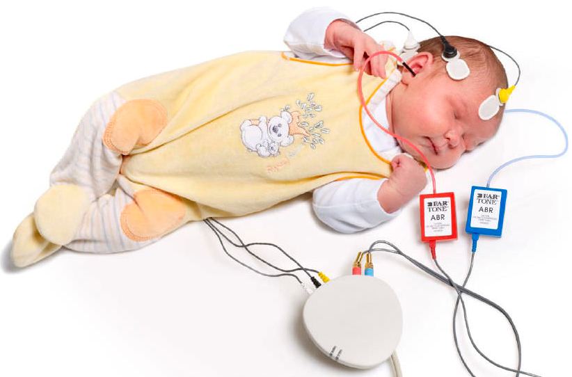 کم شنوایی نوزاد چیست و چگونه درمان می شود؟