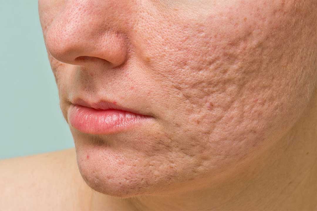5 واکنش حساسیت به لوازم آرایشی و بهداشتی