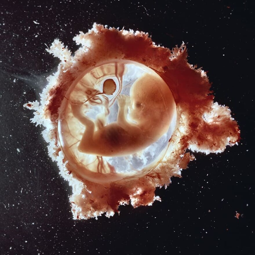 18 تصویر اعجاب‌برانگیز از روند کامل شدن جنین