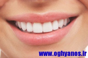 167212 - راه های ساده برای سفیدی دندان