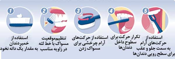 آموزش روش صحیح و بهترین زمان مسواک زدن و کشیدن نخ دندان - کلینیک دندانپزشکی  Tehran Smile
