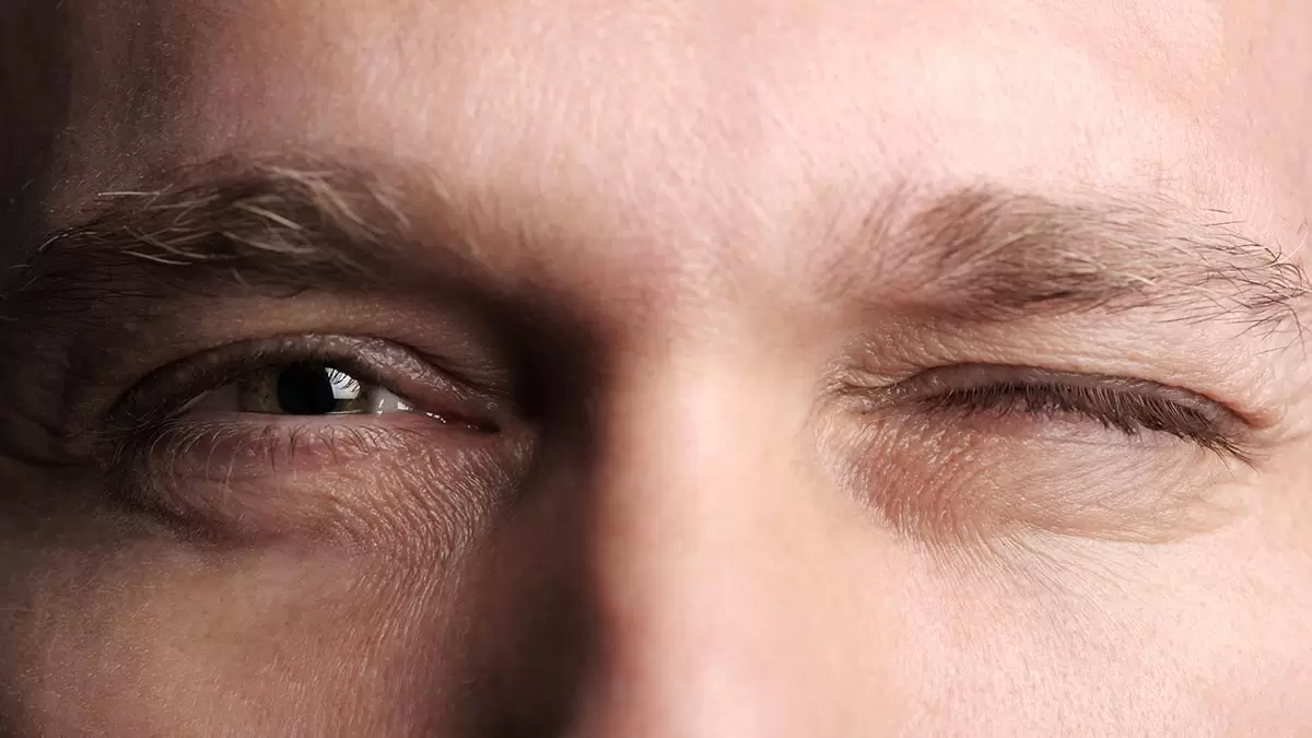 پرش پلک؛ ۱۲ علت تیک عصبی چشم+ درمان